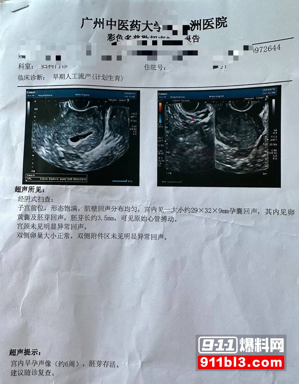 700万粉网红贵阳二小姐知三当三1 700万粉网红贵阳二小姐知三当三1