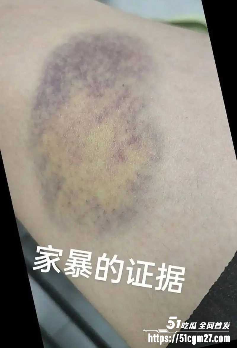 前国脚孙吉被实名举报骗婚家暴事件 22 拷贝 前国脚孙吉被实名举报骗婚家暴事件 22 拷贝