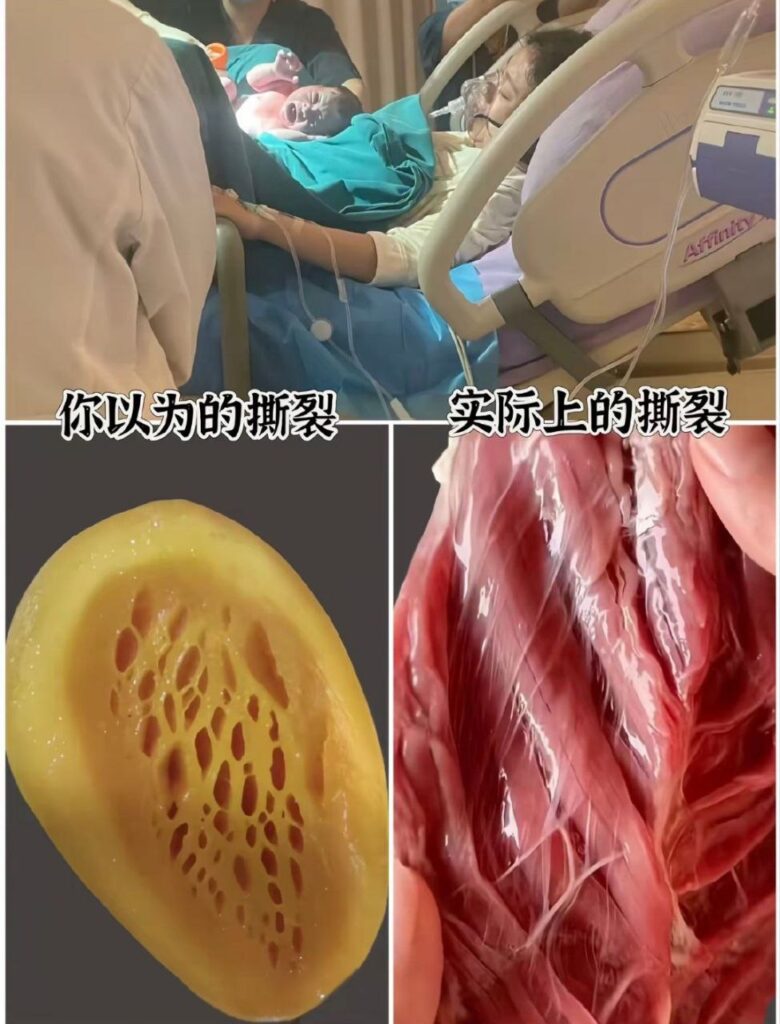 千万粉丝抖音网红保罗在美国被禁言妻子失血3344毫升还在直播