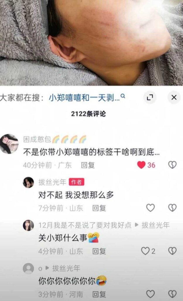 双双出轨300万粉丝网红小郑嘻嘻被前夫哥爆料出轨