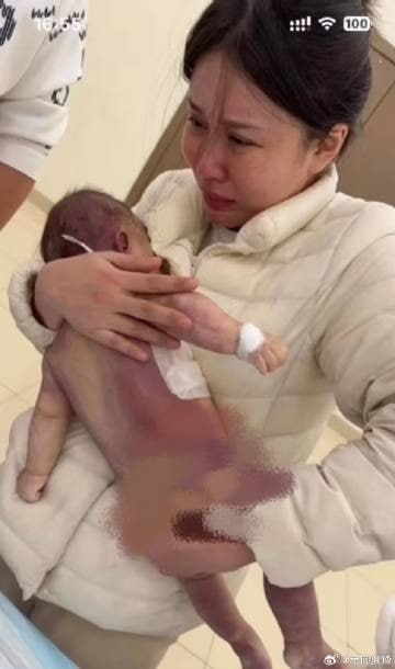 网传视频实名举报宁波大学附属医院陈贤君微创手术害死婴儿